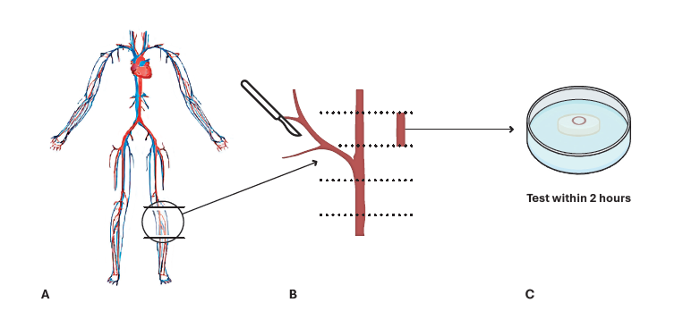  Example of tissue preparation for microindentation using human vascular tissue. (a) Human tissue is obtained on the day of surgery. (b) A region of tissue is isolated and cut for microindentation. (c) The tissue section is mounted onto the liquid agarose and gelatin embedding solution. The tissue is hydrated in 1X PBS before microindentation.
