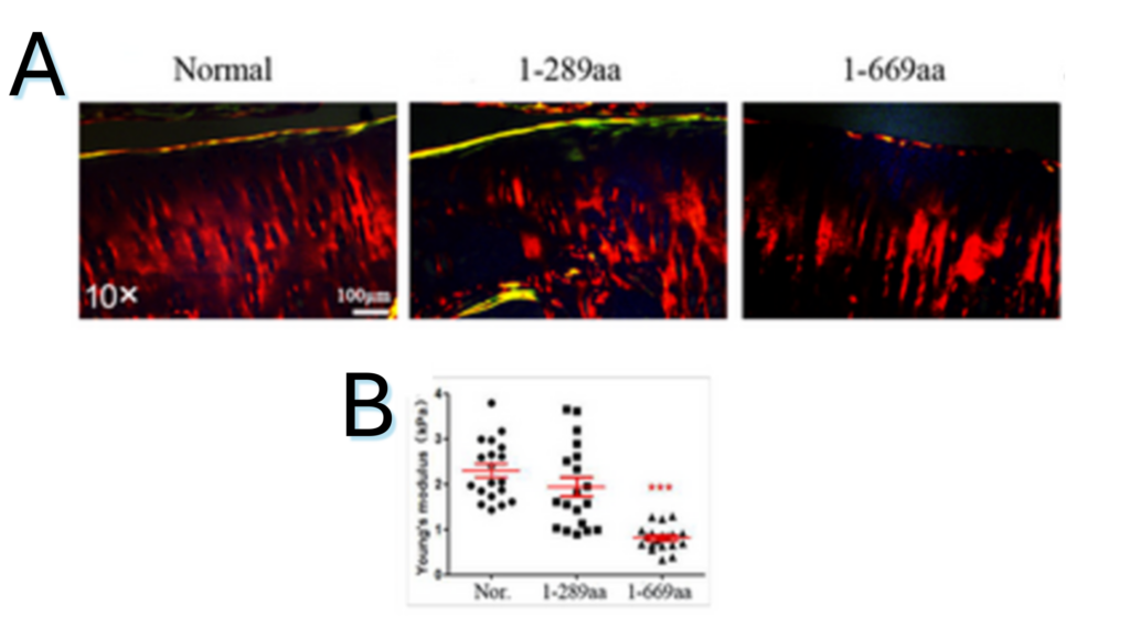 cartilage regeneration